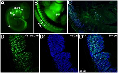 Dynamic Expression of Serotonin Receptor 5-HT3A in Developing Sensory Innervation of the Lower Urinary Tract